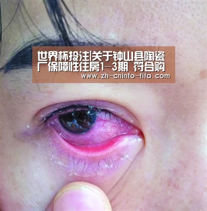 世界杯投注|关于钟山县陶瓷厂保障性住房1-3期 符合购买资格人员名单（第一批）的
